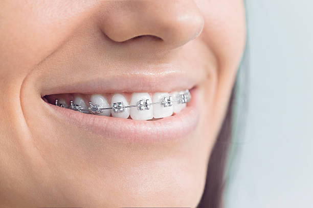 Best Traditional Braces  in Neptune City, NJ